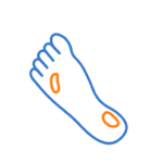 Diabetic Foot Surgery