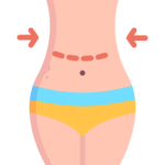 Abdominoplasty