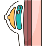 Breast reconstruction