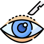 Blepharoplasty