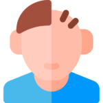 Hair Transplantation